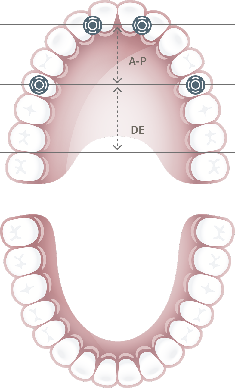 APスプレッド理論とは？