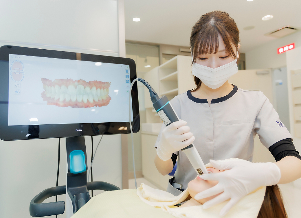 iTero(3Dスキャナー)