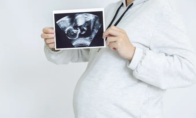 妊娠中に気をつけるべき歯のケアとは？