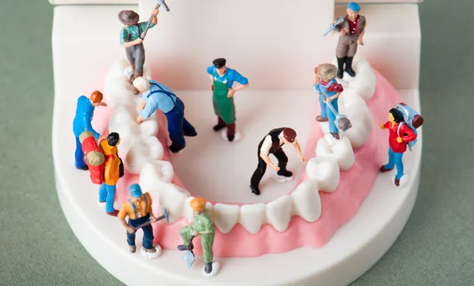 歯周病を予防するためのポイント