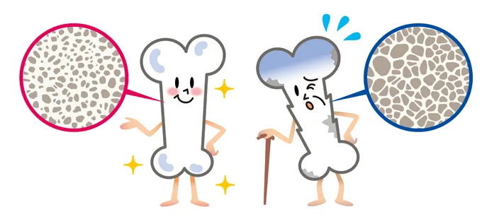 2.カルシウム不足で歯はもろくなる？