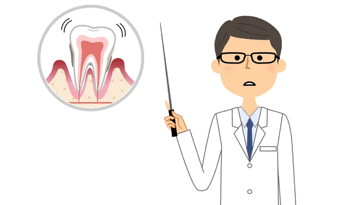 歯周病とは？