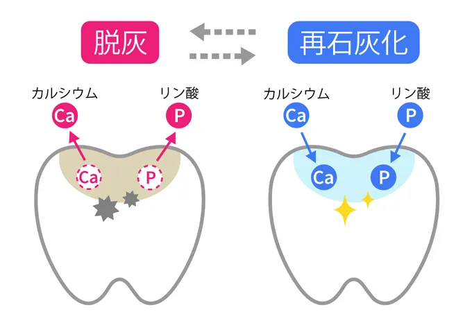 虫歯予防は再石灰化の促進が大切！今日からできる取り組み3つ