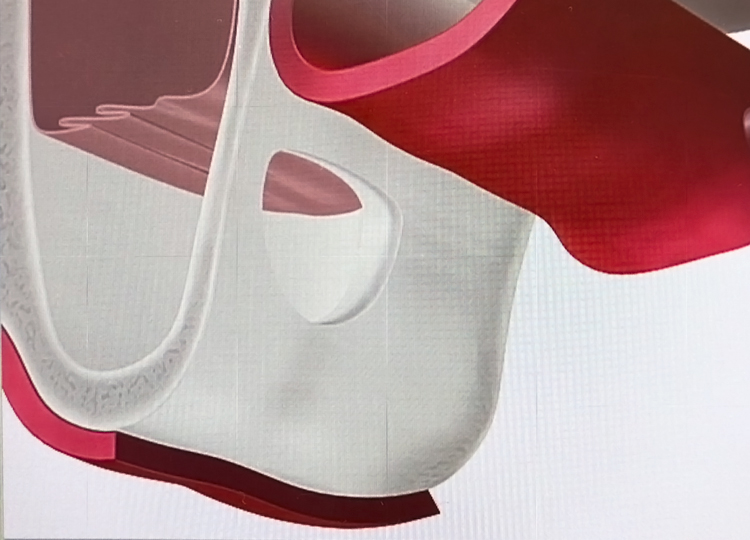 サイナスリフト