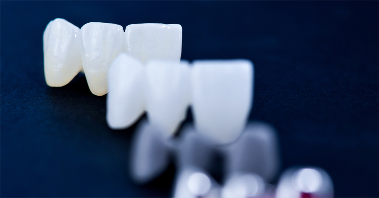 上部構造(Zr/Zr Ce/MB)