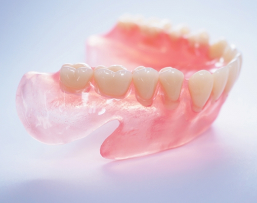 入れ歯・ブリッジとの違い