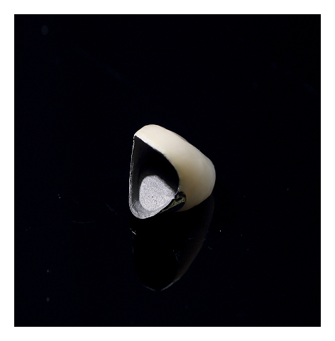 MB(フルベイク・カラーレス)