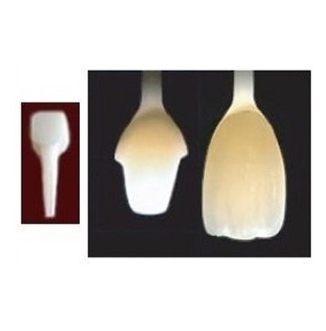 ファイバーコア