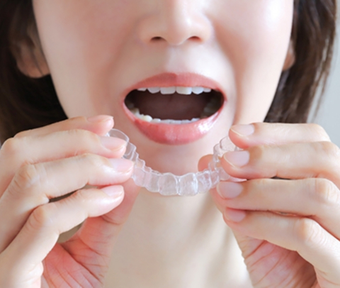 ホームホワイトニング